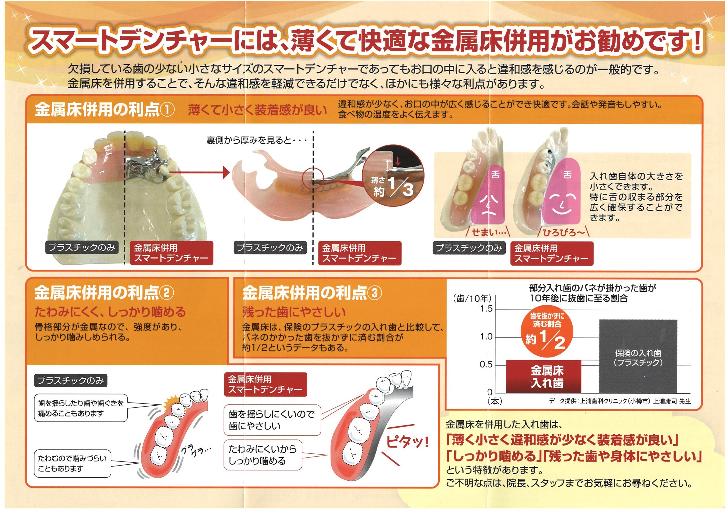 金属床の特徴について